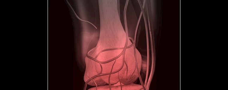 Knee treatment with robotics